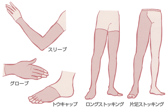 リンパ浮腫治療用弾性衣類の種類
